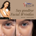 Botox - Say Goodbye to Facial Wrinkles