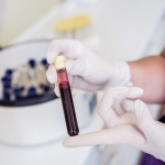 Platelet-Rich Plasma Makes It Possible To Help Yourself Heal