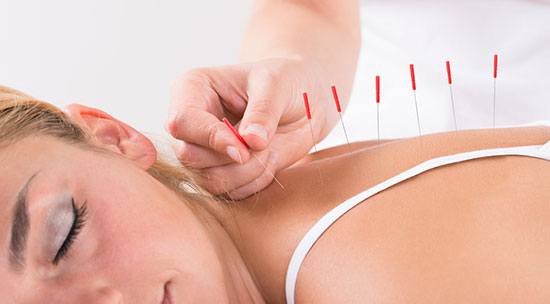 Acupuncture/Cupping